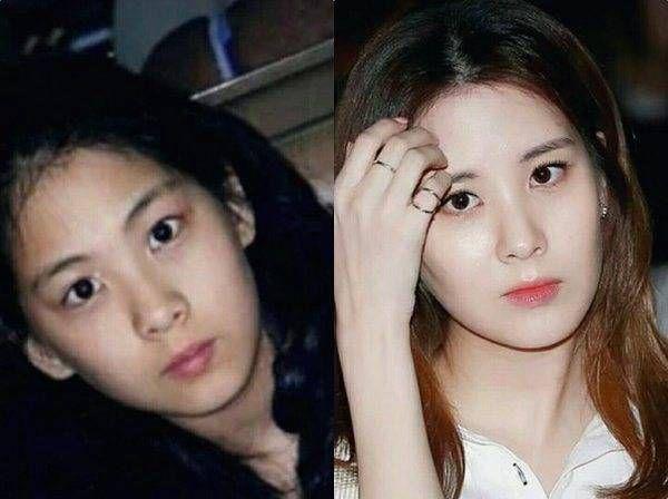 11 Potret Transformasi Seohyun SNSD yang Berubah Drastis, Glowing!