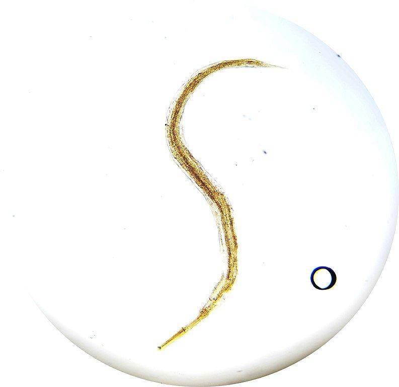 Enterobius vermicularis atau cacing kremi. (commons.wikimedia.org/Danny S.)