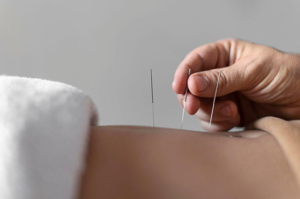 Keamanan, Manfaat, dan Teknik Akupunktur untuk Pasien Diabetes