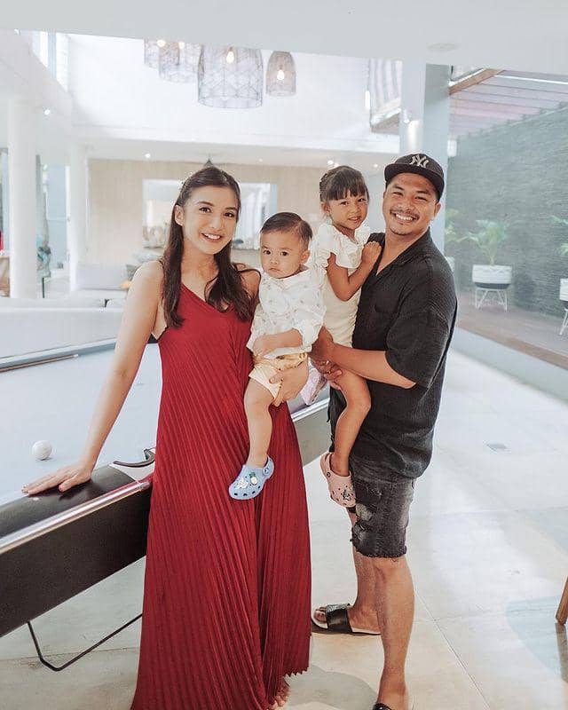 Chelsea Olivia dengan gigi Gingsul (instagram.com/chelseaoliviaa)