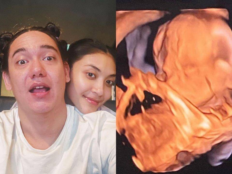 Adipati Dolken dan Canti Tachril umumkan kehamilan. (instagram.com/adipati)