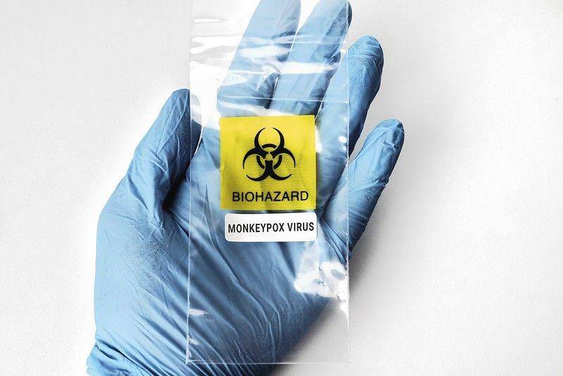 ilustrasi virus monkeypox (flickr.com/The Focal Project)