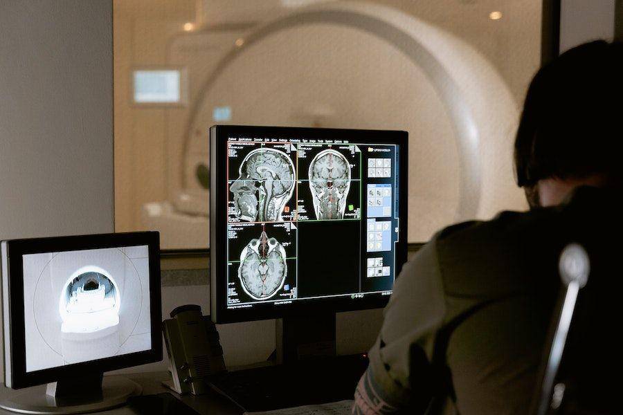ilustrasi MRI (pexels.com/MART Productions)