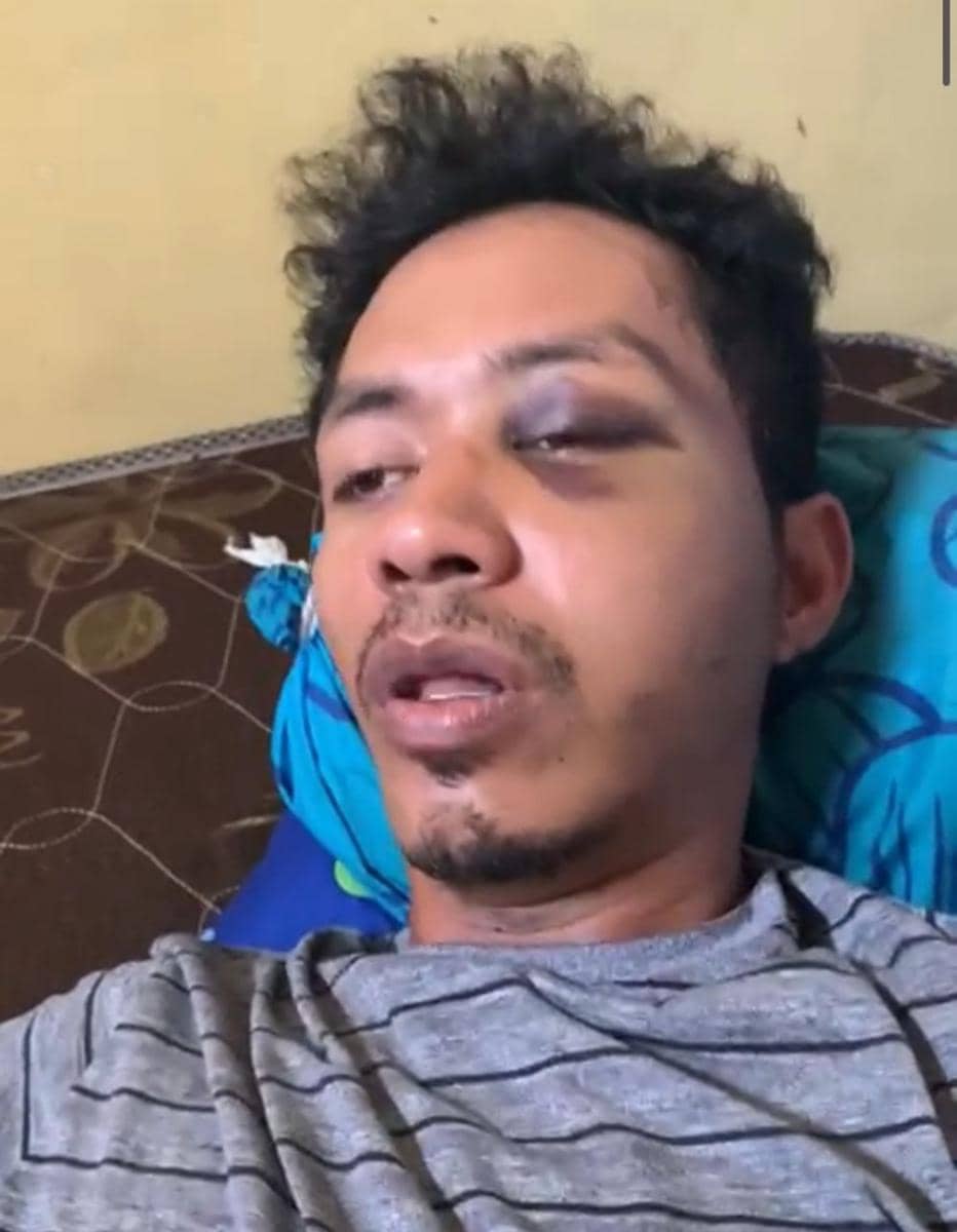 Korban dugaan salah tangkap Aidil (Dok: istimewa)