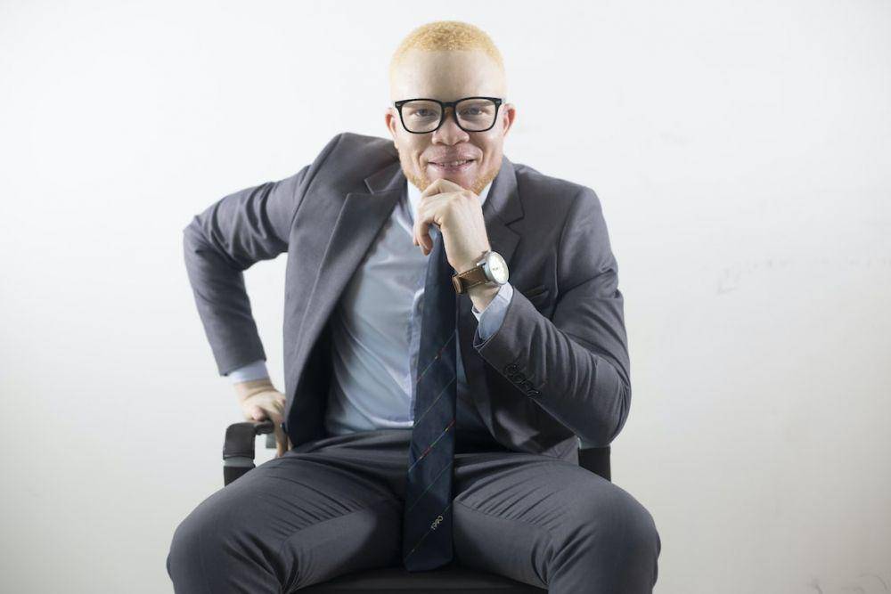 Ilustrasi orang dengan albino. (Unsplash.com/kelisa Bernard)