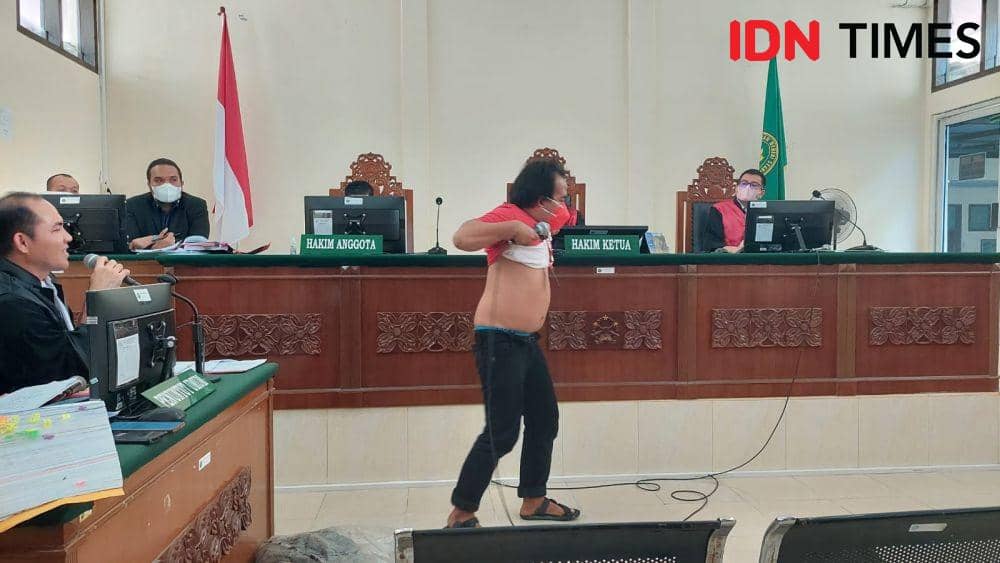 Saksi yang merupakan mantan penghuni kerangkeng tunjukan luka diselang (IDN Times/ Bambang Suhandoko)