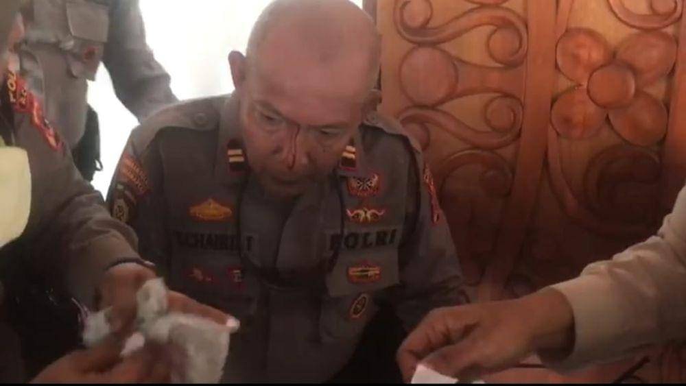 Salah seorang personel kepolisian menjadi korban bentrokan di depan Gedung DPRA. (Dokumentasi Polda Aceh untuk IDN Times)