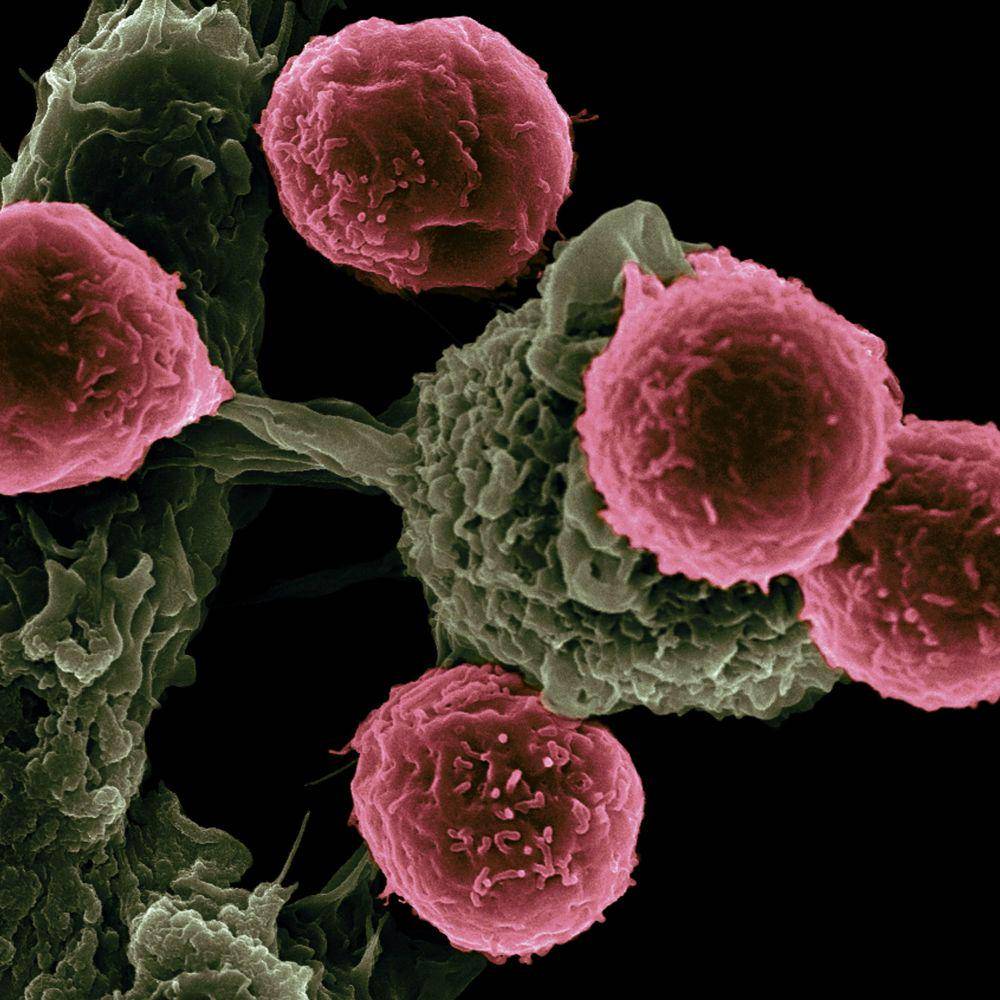 ilustrasi sel kanker (unsplash.com/National Cancer Institute)