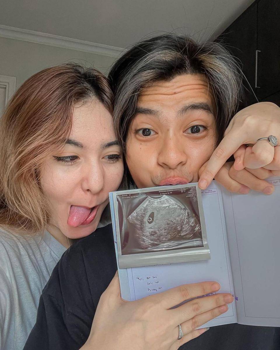 potret Arnold Leonard dan Moniq Crasivaya (instagram.com/arnoldleonard05)