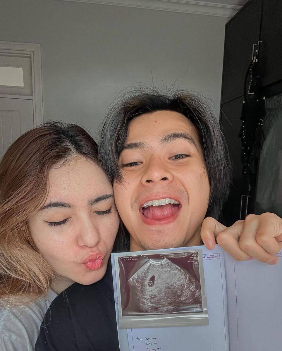 potret Arnold Leonard dan Moniq Crasivaya (instagram.com/arnoldleonard05)