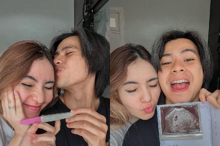 Umumkan Hamil Anak Pertama, 10 Potret Bahagia Arnold Leonard dan Istri