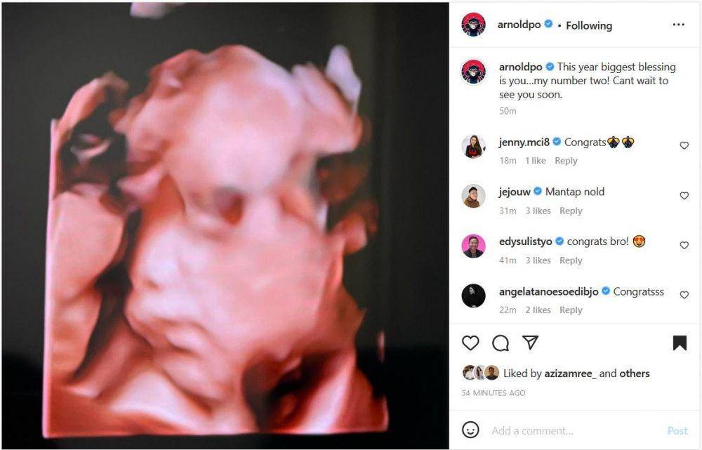 Arnold Poernomo dan keluarga (Instagram.com/arnoldpo/)