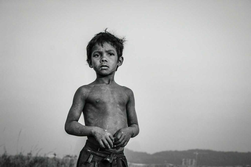 Kelaparan Parah dapat Menyebabkan Refeeding Syndrome, Kondisi Apa Itu?