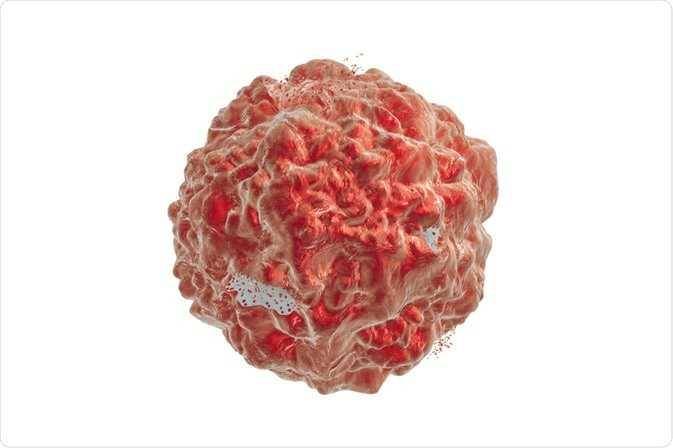 ilustrasi sindrom lisis tumor (news-medical.net)