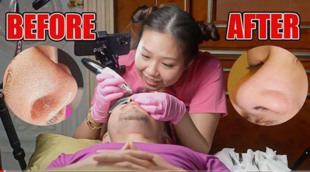 Sisca Kohl membersihkan komedo Jess No Limit. (youtube.com/Jess No Limit)