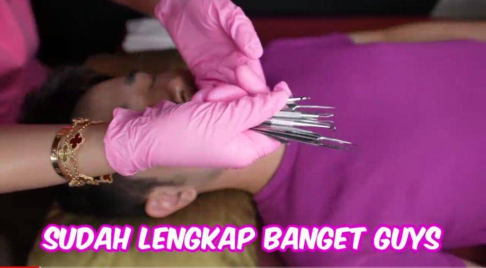 Sisca Kohl membersihkan komedo Jess No Limit. (youtube.com/Jess No Limit)
