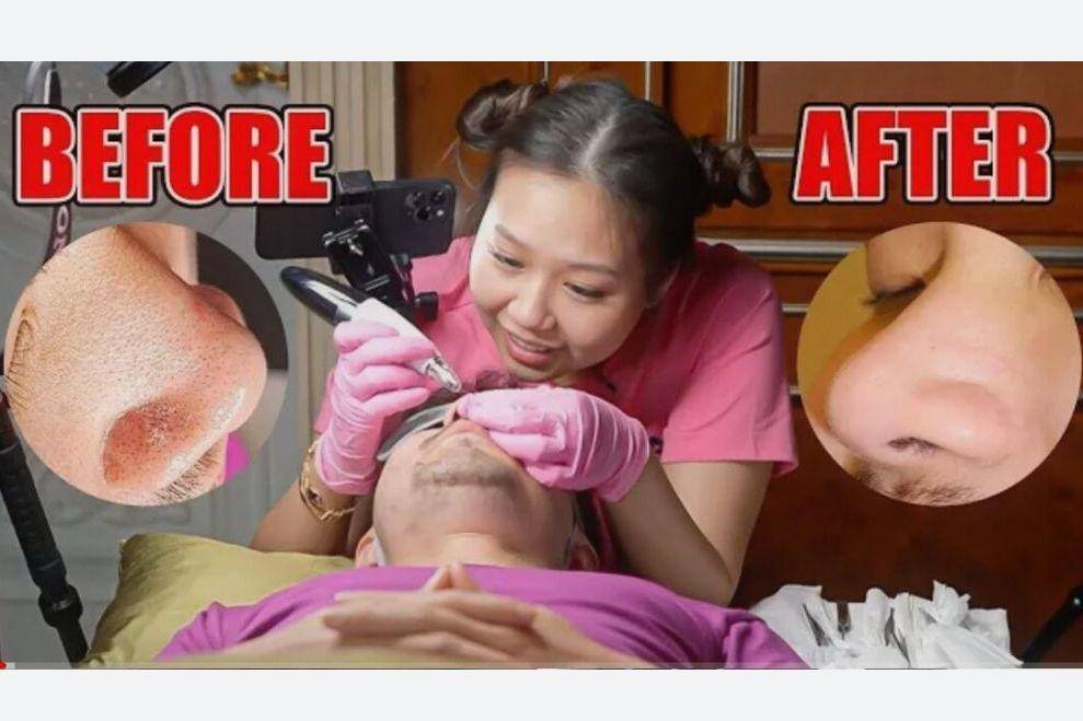 Sisca Kohl membersihkan komedo Jess No Limit. (youtube.com/Jess No Limit)