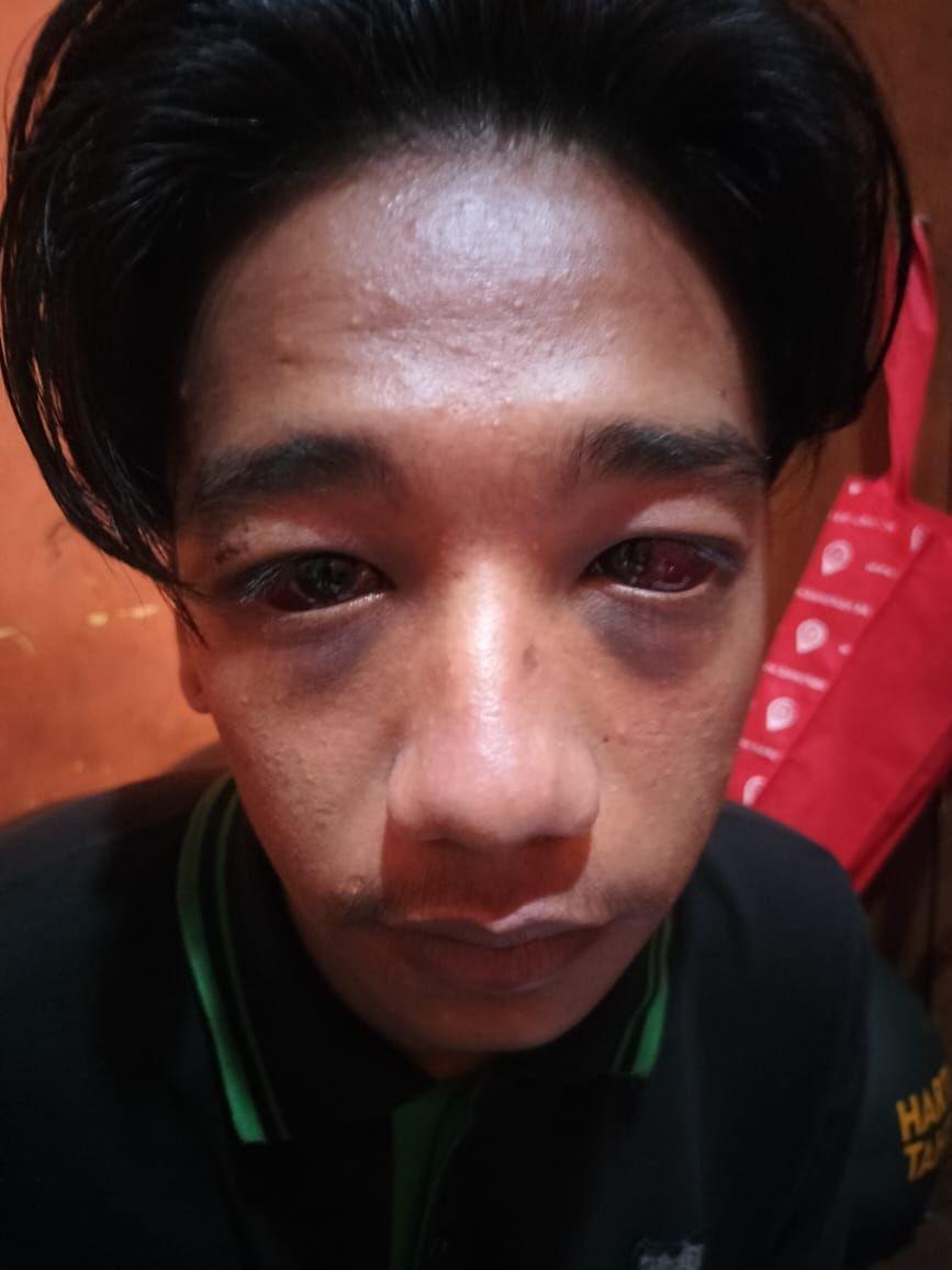 Tragedi Kanjuruhan Sudah 10 Hari Berlalu, Mata Geri Masih Merah Darah