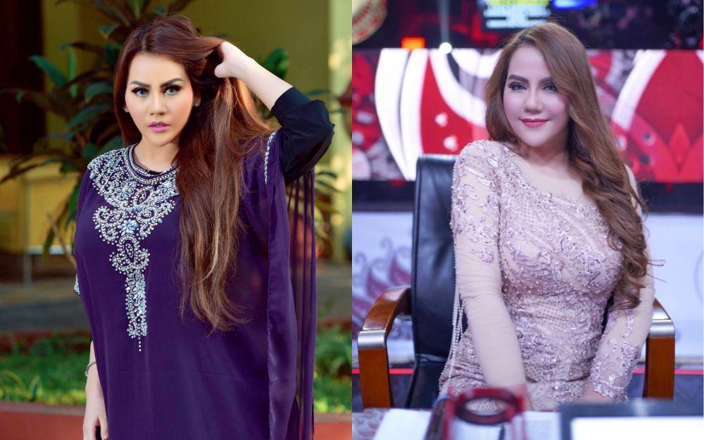 Kabar Terbaru Nita Thalia, Idap Kerusakan Saraf Otak Level 4
