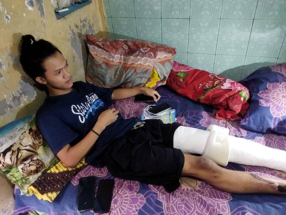 Kondisi Bagus belum bisa beraktivitas normal. Dok/istimewa