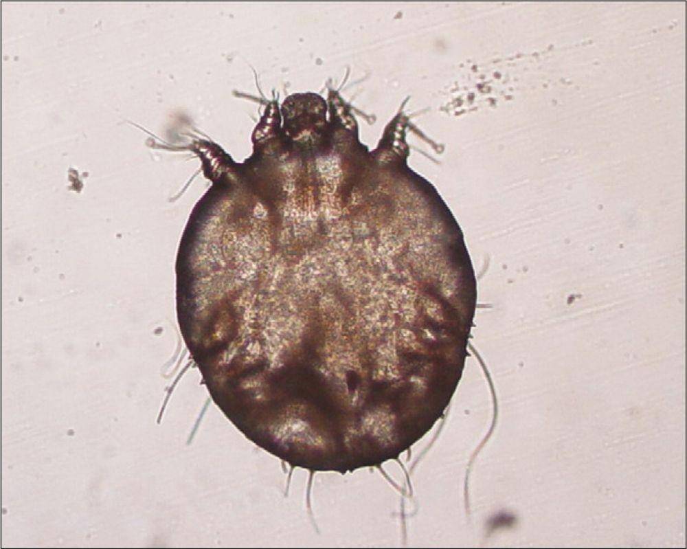 ilustrasi tungau Sarcoptes scabiei (thelancet.com/Clinical Picture/Volume 11, Issue 1, P72, January 01, 2011)