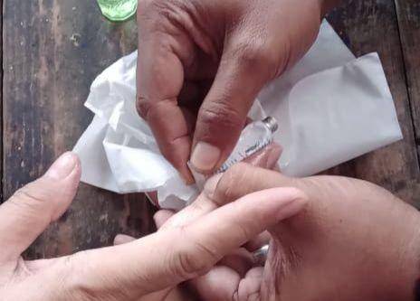Proses pelepasan botol lem super dari jari. (Dokumen Damkar Kota Bekasi)