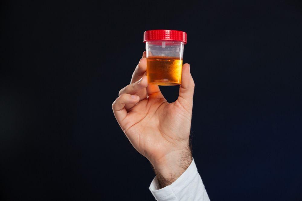 9 Penyebab Perubahan Bau Urine, Tanda Penyakit?