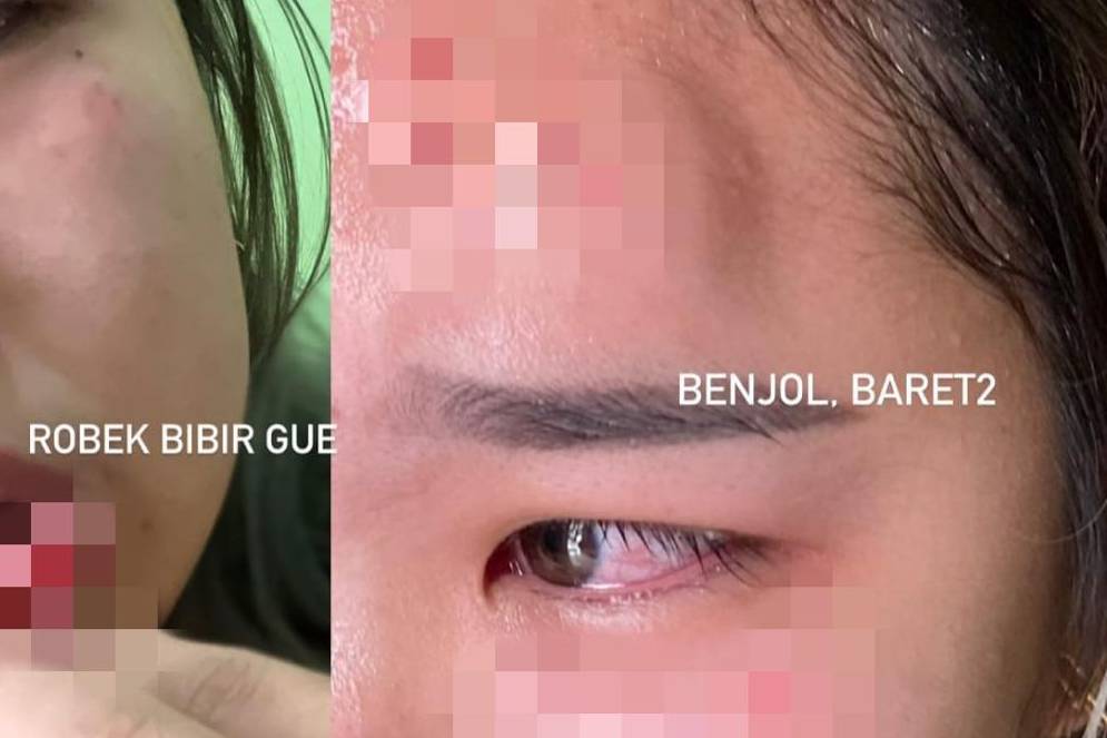 Kekerasan pada ibu muda di Tangerang Selatan (dok. IDN Times/Istimewa)
