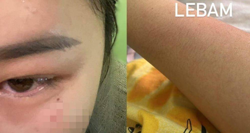 Kekerasan pada ibu muda di Tangerang Selatan (dok. IDN Times/Istimewa)