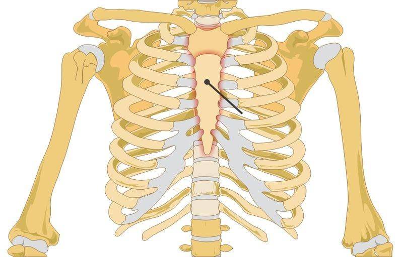 ilustrasi anatomi tulang dada (wikimedia.org)
