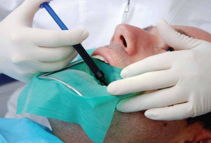 ilustrasi perawatan saluran akar gigi atau perawatan endodontik (aae.org)