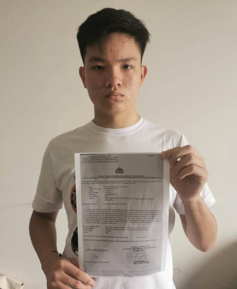 Polisi sudah menerima laporan Nelson (Istimewa)