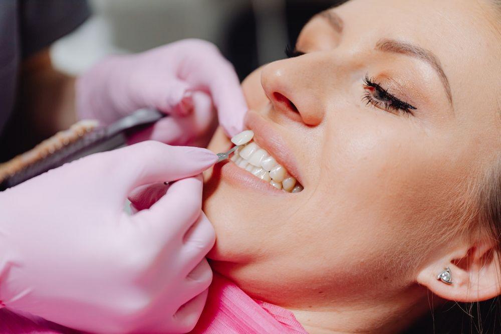 6 Mitos dan Fakta mengenai Veneer Gigi, Buat yang Masih Ragu!