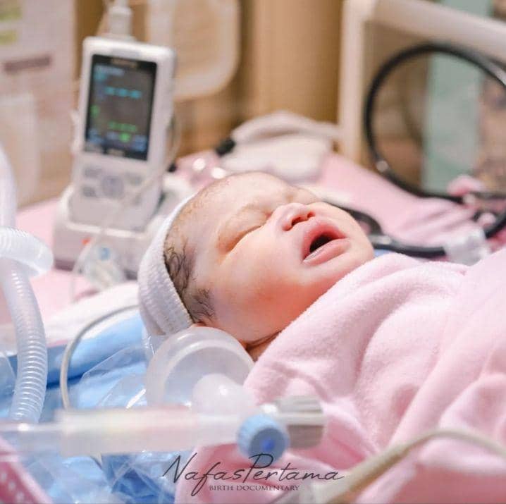 potret Amela Zoya anak Mad Kucil (instagram.com/amelazoya)