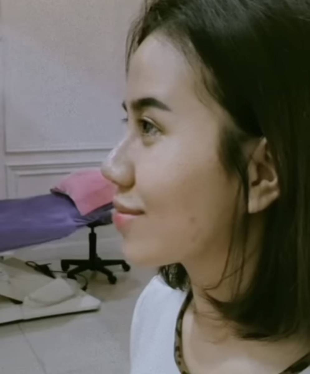 potret terkini wajah Mayang adik Vanessa Angel (instagram.com/dodysoedrajat_1)