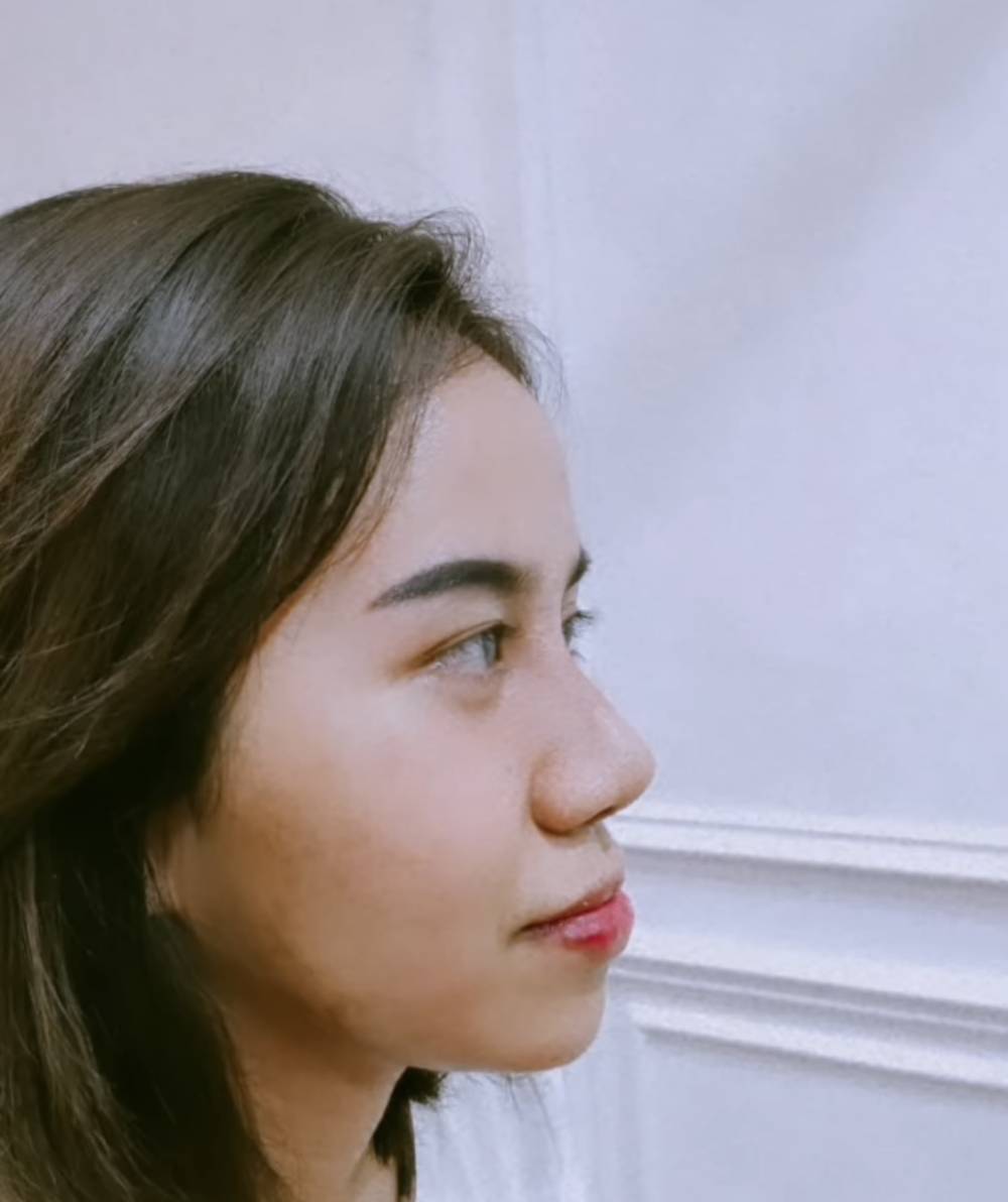 potret terkini wajah Mayang adik Vanessa Angel (instagram.com/dodysoedrajat_1)