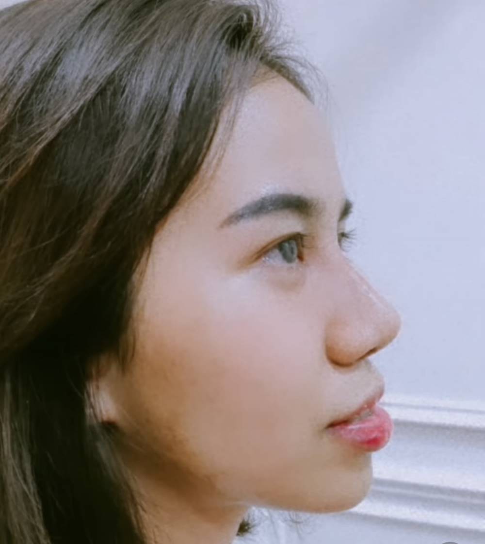 potret terkini wajah Mayang adik Vanessa Angel (instagram.com/dodysoedrajat_1)