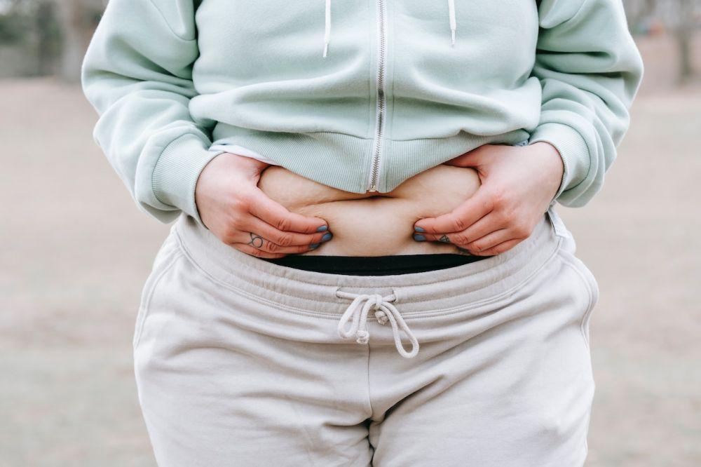 Kenapa, sih, Bisa Muncul Stretch Mark di Kulit?