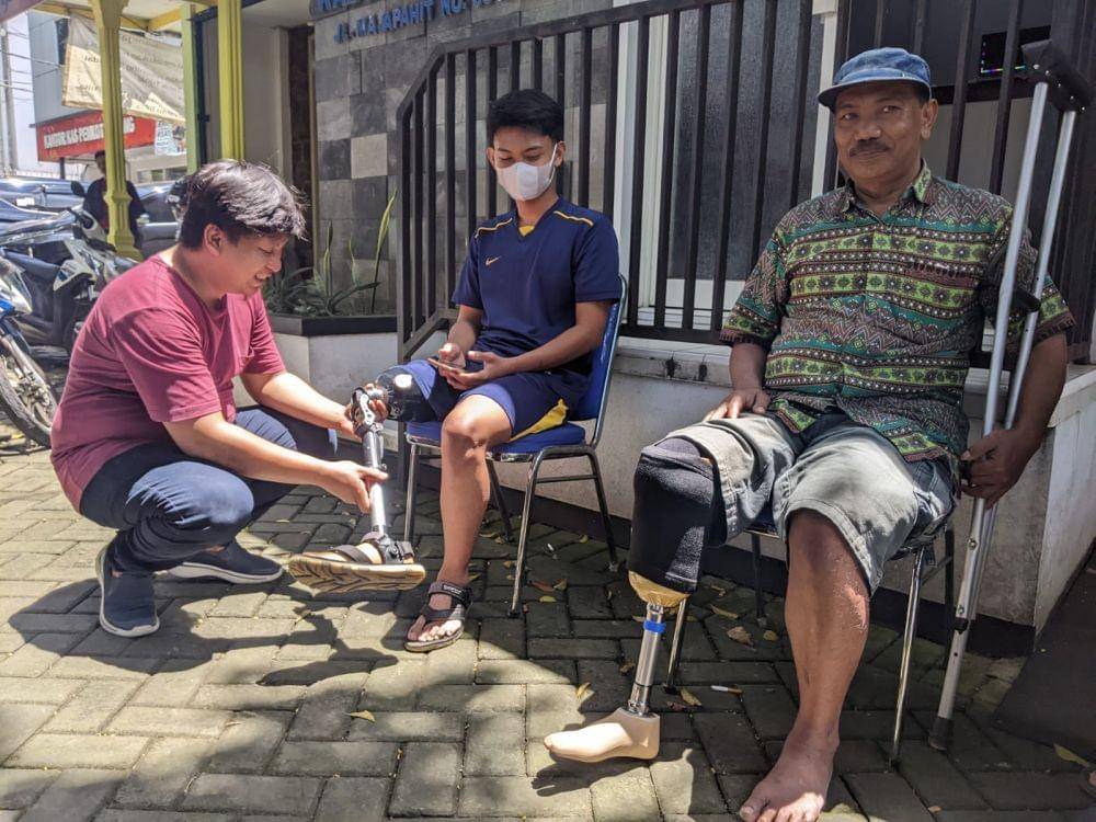 Salah satu anak penerima kaki palsu di Kabupaten Malang. (Foto: Rizal Adhi Pratama)