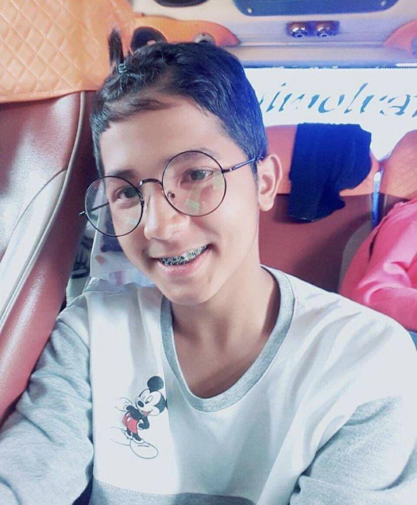 potret Jirayut pakai kawat gigi (instagram.com/jirayutdaa4official)