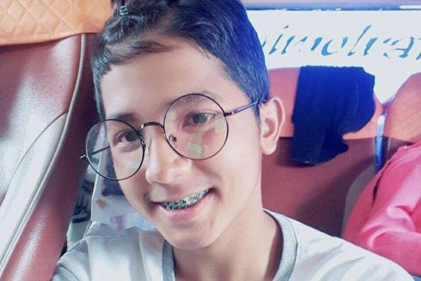 potret Jirayut pakai kawat gigi (instagram.com/jirayutdaa4official)