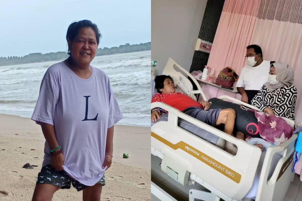 Kaki Suti Karno Harus Diamputasi Setelah 18 Tahun Diabetes