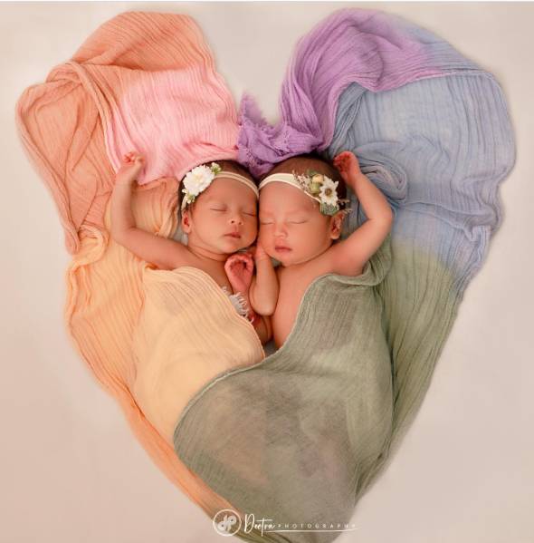 Baby twin Anisa Rahma, lmashira Atqiya Shanum dan Alshamira Afiza Shanum. (instagram.com/aanisarahma_12)