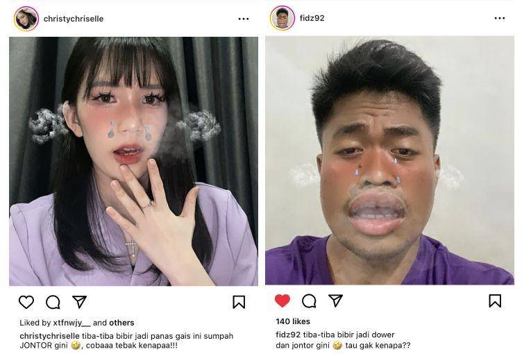 Influencer mendadak bibirnya jontor (Dok. Pop Mie)