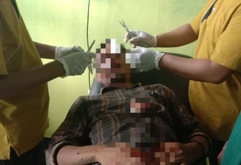 Korban saat dirawat di puskesmas (Dok/Polsek Hu'u)