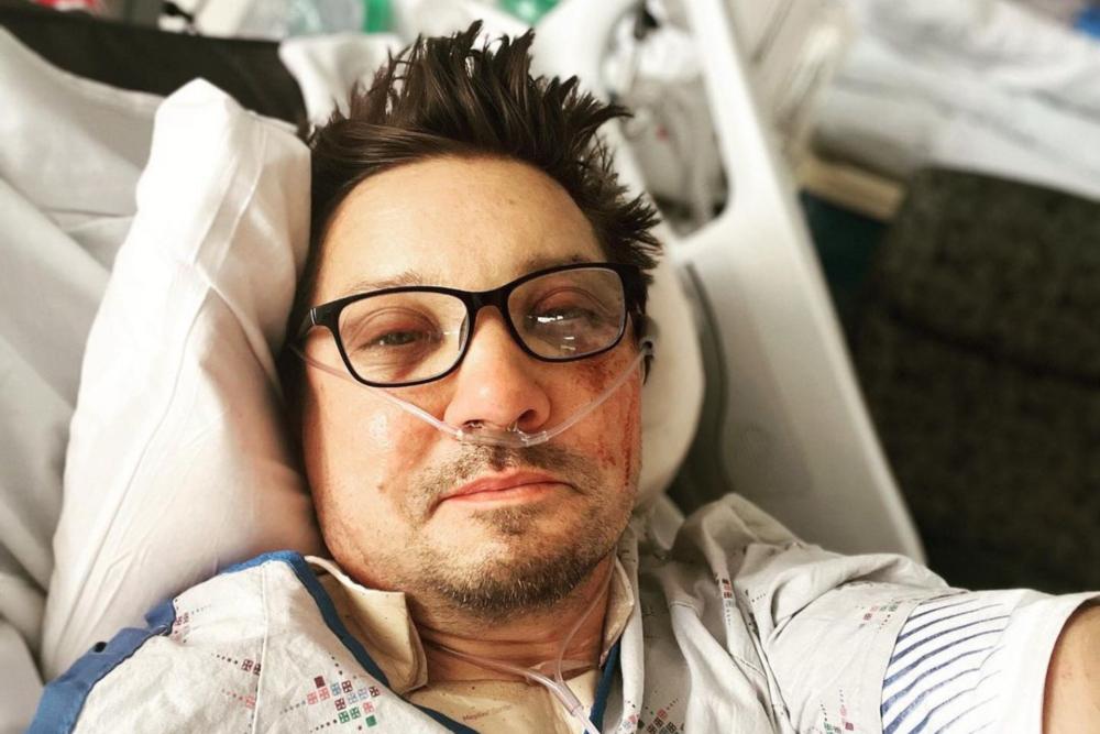 Kondisi Terkini Jeremy Renner Hawkeye Pasca Kecelakaan, Uptade Selfie!