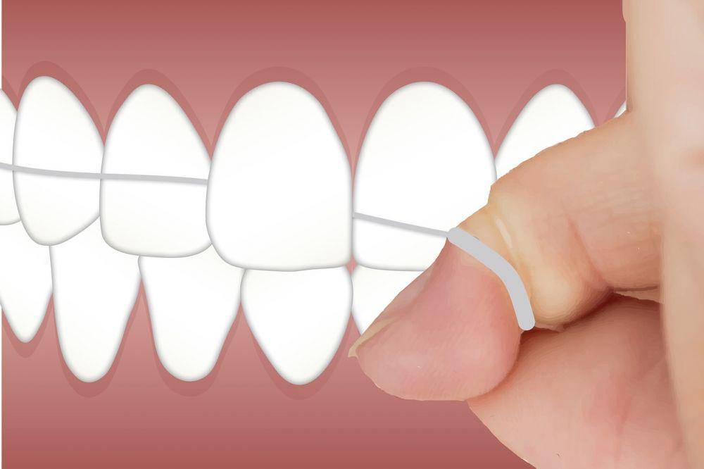 Ilustrasi dental floss (pixabay.com/kreatikar)