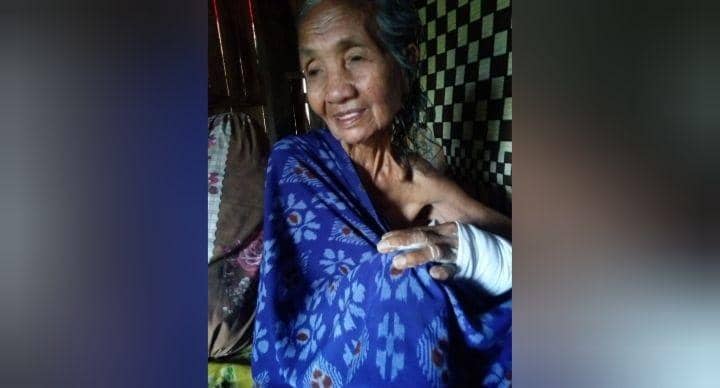 Gegara Kayu Bakar, Nenek di Bima ini Dibacok oleh Tetangganya
