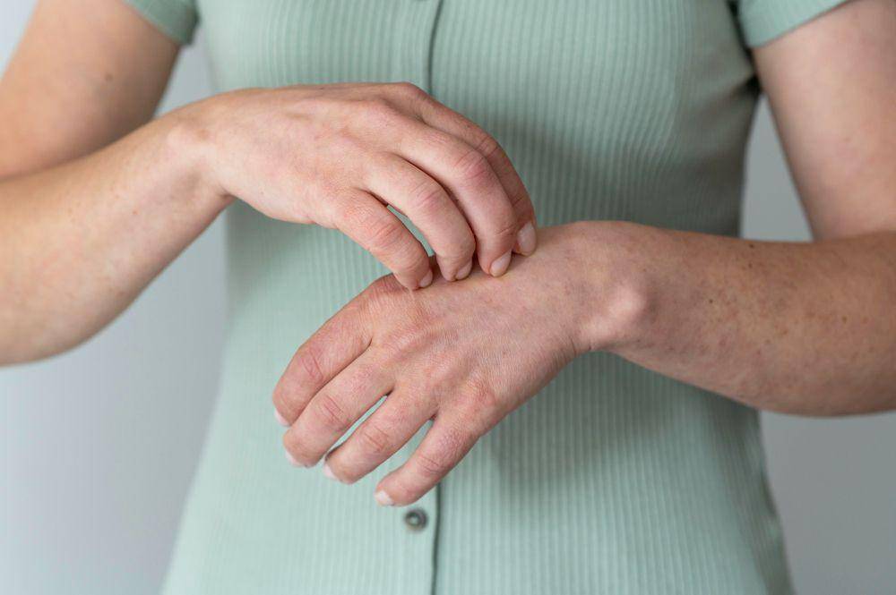 ilustrasi penderita artritis psoriasis di tangan (freepik.com/freepik)