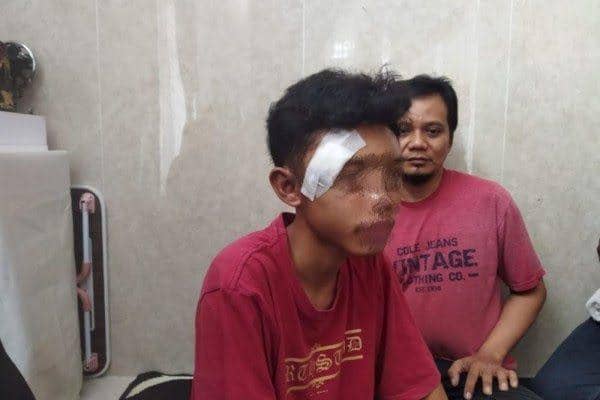 Kondisi MF yang babak belur usai mengalami penganiayaan. (IDN Times/istimewa)